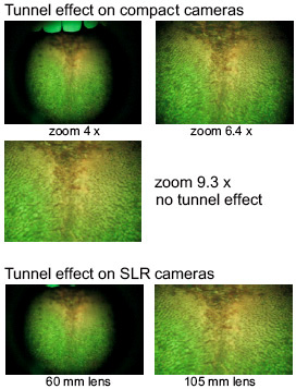 velscope screening